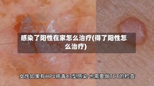 感染了阳性在家怎么治疗(得了阳性怎么治疗)-第1张图片