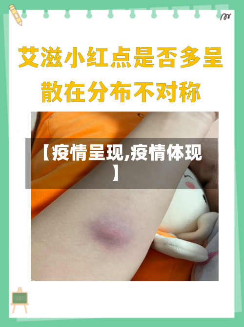 【疫情呈现,疫情体现】-第1张图片