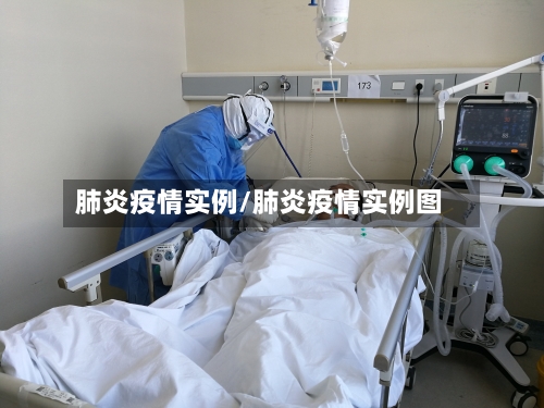肺炎疫情实例/肺炎疫情实例图-第2张图片
