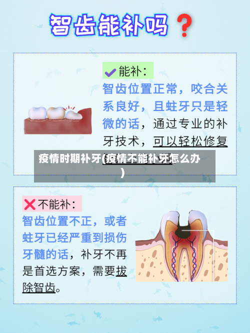 疫情时期补牙(疫情不能补牙怎么办)-第3张图片